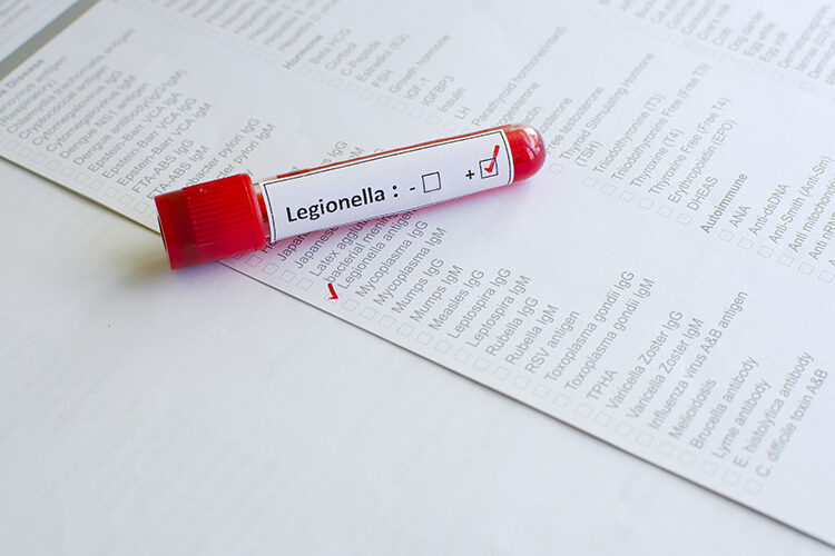 PE0724_legionella test.jpg